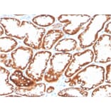 Immunohistochemistry - Anti-CD137 Antibody [4-1BB/3201] (Biotin) (A251222) - Antibodies.com