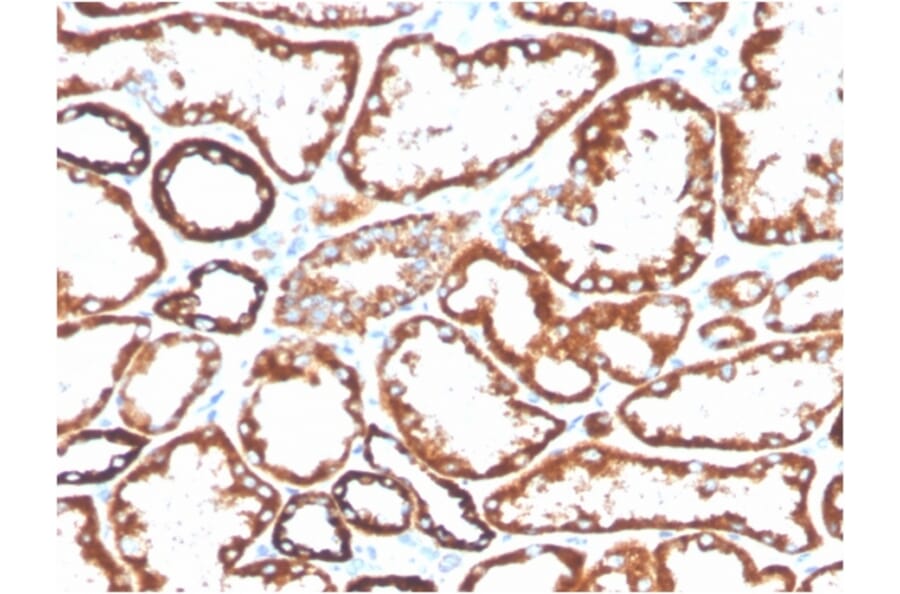 Immunohistochemistry - Anti-CD137 Antibody [4-1BB/3201] (Biotin) (A251222) - Antibodies.com
