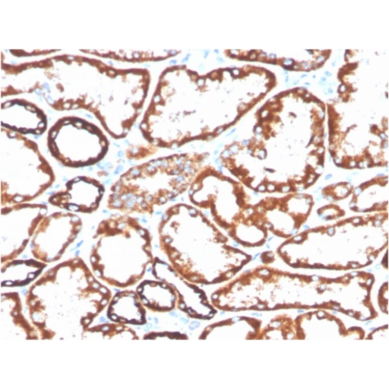 Immunohistochemistry - Anti-CD137 Antibody [4-1BB/3201] (Biotin) (A251222) - Antibodies.com