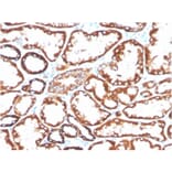 Immunohistochemistry - Anti-CD137 Antibody [4-1BB/3201] (Biotin) (A251222) - Antibodies.com