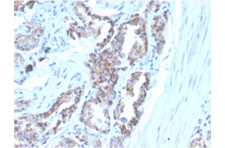 Immunohistochemistry - Anti-Cytokeratin 7 Antibody [OV-TL12/30] (Biotin) (A251222) - Antibodies.com
