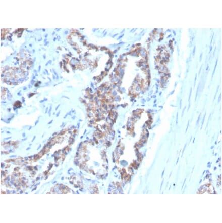 Immunohistochemistry - Anti-Cytokeratin 7 Antibody [OV-TL12/30] (Biotin) (A251222) - Antibodies.com