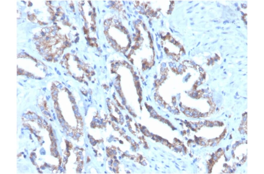 Immunohistochemistry - Anti-Cytokeratin 7 Antibody [OV-TL12/30] (Biotin) (A251223) - Antibodies.com
