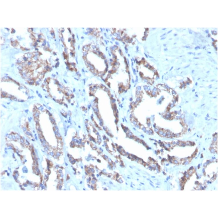 Immunohistochemistry - Anti-Cytokeratin 7 Antibody [OV-TL12/30] (Biotin) (A251223) - Antibodies.com