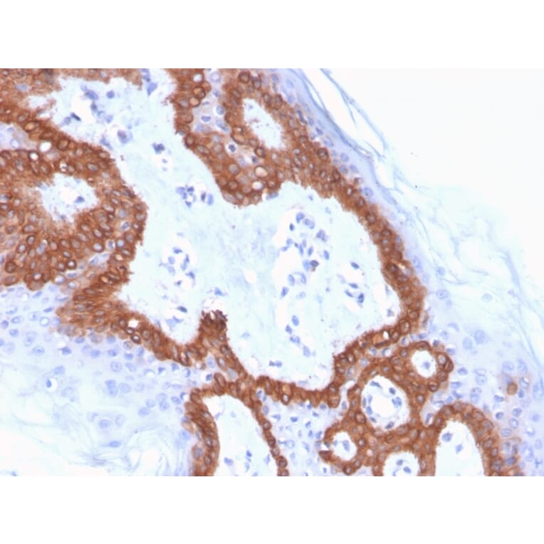 Immunohistochemistry - Anti-Cytokeratin 14 Antibody [LL002] (Biotin) (A251224) - Antibodies.com