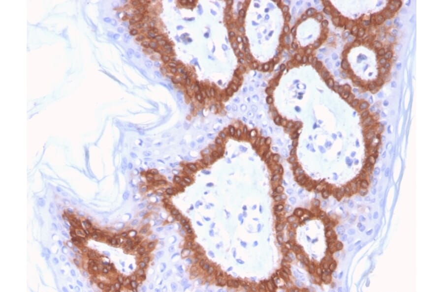 Immunohistochemistry - Anti-Cytokeratin 14 Antibody [LL002] (Biotin) (A251223) - Antibodies.com