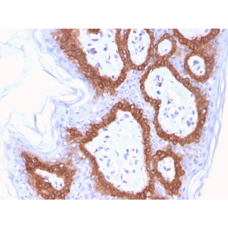 Immunohistochemistry - Anti-Cytokeratin 14 Antibody [LL002] (Biotin) (A251223) - Antibodies.com