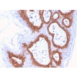 Immunohistochemistry - Anti-Cytokeratin 14 Antibody [LL002] (Biotin) (A251223) - Antibodies.com