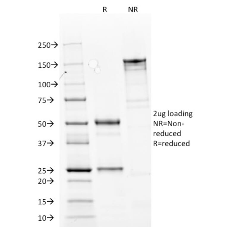 SDS-PAGE - Anti-Cytokeratin 14 Antibody [LL002] (Biotin) (A251224) - Antibodies.com
