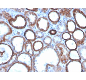 Immunohistochemistry - Anti-TROP2 Antibody [TACSTD2/2151] (Biotin) (A251225) - Antibodies.com