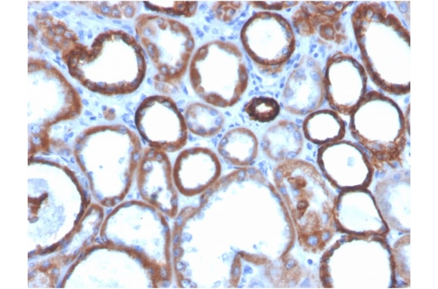 Immunohistochemistry - Anti-TROP2 Antibody [TACSTD2/2151] (Biotin) (A251225) - Antibodies.com