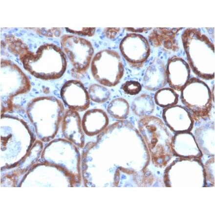Immunohistochemistry - Anti-TROP2 Antibody [TACSTD2/2151] (Biotin) (A251225) - Antibodies.com