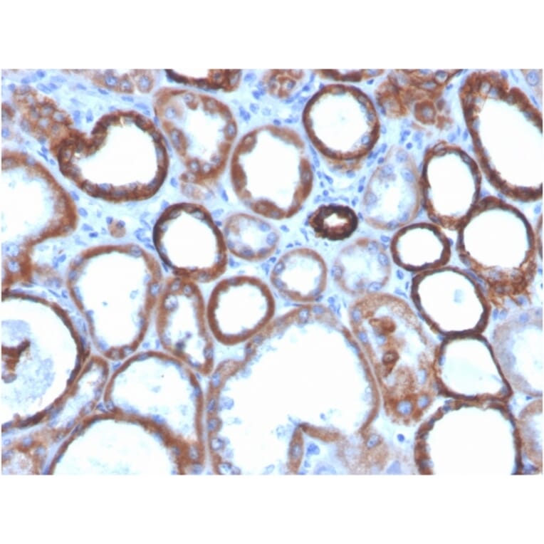 Immunohistochemistry - Anti-TROP2 Antibody [TACSTD2/2151] (Biotin) (A251225) - Antibodies.com