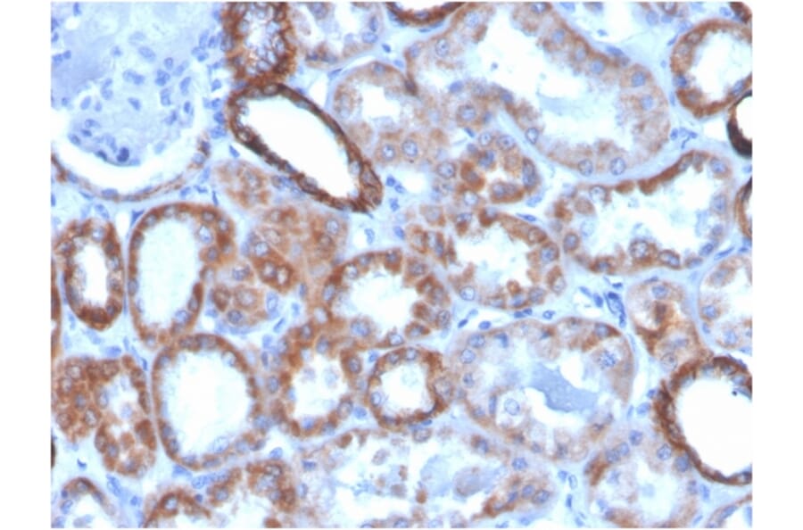 Immunohistochemistry - Anti-TROP2 Antibody [TACSTD2/2151] (Biotin) (A251225) - Antibodies.com