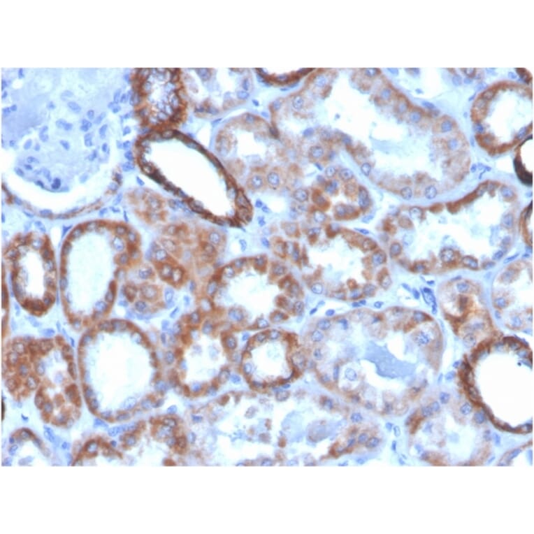 Immunohistochemistry - Anti-TROP2 Antibody [TACSTD2/2151] (Biotin) (A251225) - Antibodies.com