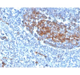 Immunohistochemistry - Anti-CD73 Antibody [NT5E/2646] (Biotin) (A251226) - Antibodies.com