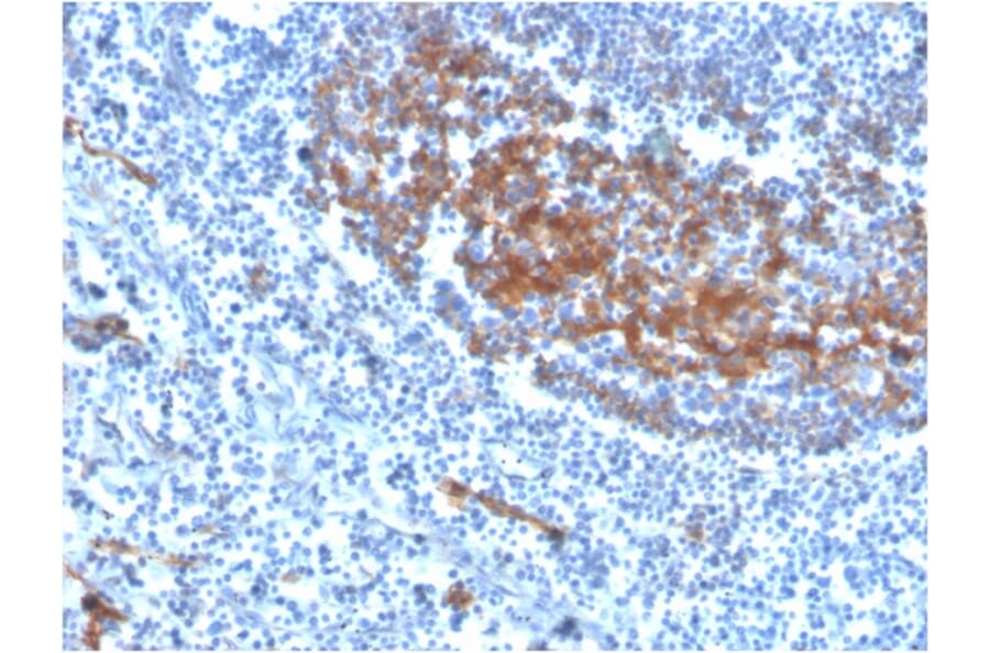 Immunohistochemistry - Anti-CD73 Antibody [NT5E/2646] (Biotin) (A251226) - Antibodies.com