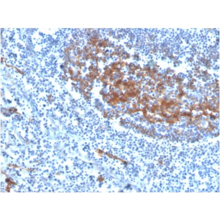 Immunohistochemistry - Anti-CD73 Antibody [NT5E/2646] (Biotin) (A251226) - Antibodies.com