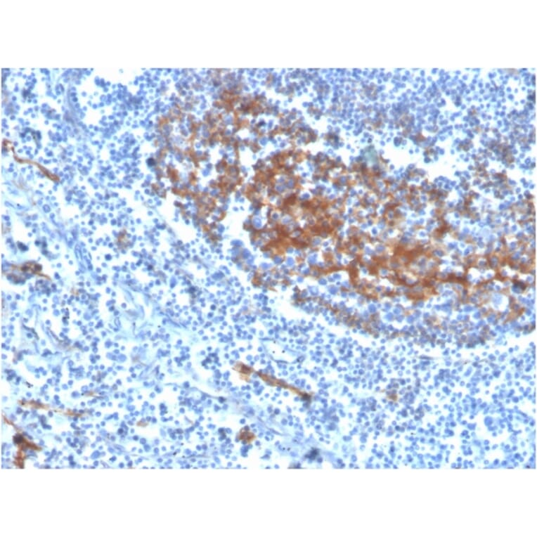 Immunohistochemistry - Anti-CD73 Antibody [NT5E/2646] (Biotin) (A251226) - Antibodies.com