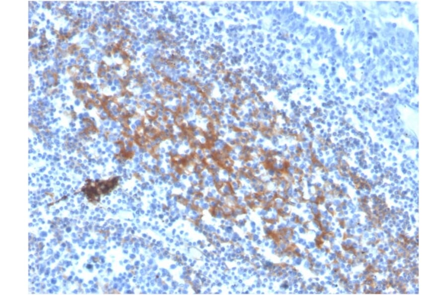 Immunohistochemistry - Anti-CD73 Antibody [NT5E/2646] (Biotin) (A251226) - Antibodies.com