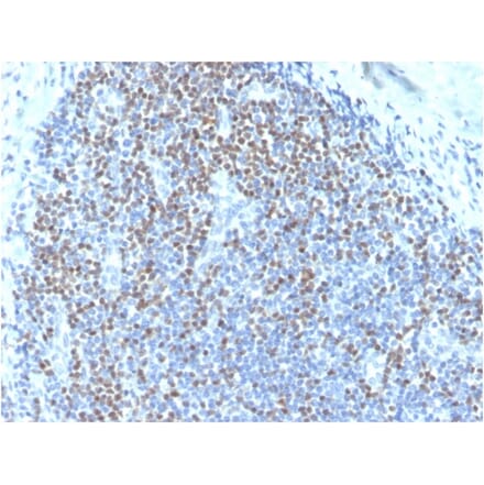 Immunohistochemistry - Anti-PAX5 Antibody [PAX5/3735] (Biotin) (A251227) - Antibodies.com