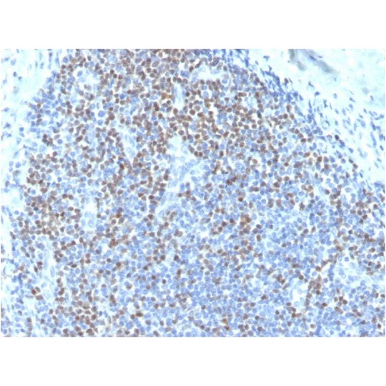 Immunohistochemistry - Anti-PAX5 Antibody [PAX5/3735] (Biotin) (A251227) - Antibodies.com