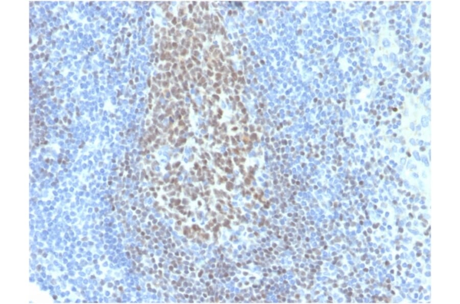 Immunohistochemistry - Anti-PAX5 Antibody [PAX5/3735] (Biotin) (A251226) - Antibodies.com