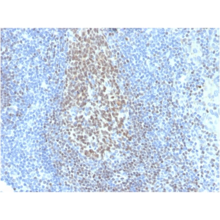 Immunohistochemistry - Anti-PAX5 Antibody [PAX5/3735] (Biotin) (A251226) - Antibodies.com