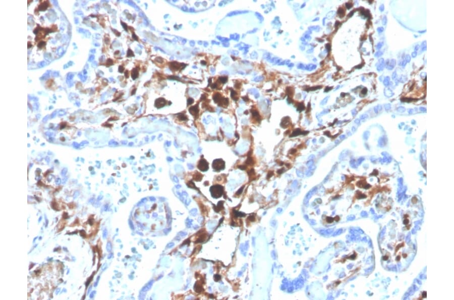 Immunohistochemistry - Anti-S100A4 Antibody [S100A4/1481] (Biotin) (A251228) - Antibodies.com