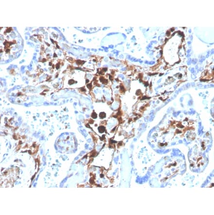Immunohistochemistry - Anti-S100A4 Antibody [S100A4/1481] (Biotin) (A251228) - Antibodies.com