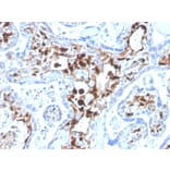 Immunohistochemistry - Anti-S100A4 Antibody [S100A4/1481] (Biotin) (A251228) - Antibodies.com