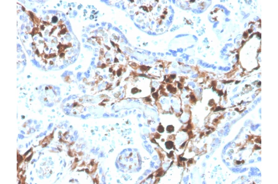 Immunohistochemistry - Anti-S100A4 Antibody [S100A4/1481] (Biotin) (A251228) - Antibodies.com