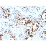 Immunohistochemistry - Anti-S100A4 Antibody [S100A4/1481] (Biotin) (A251228) - Antibodies.com