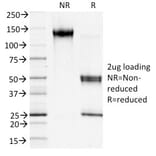 SDS-PAGE - Anti-S100A4 Antibody [S100A4/1481] (Biotin) (A251228) - Antibodies.com