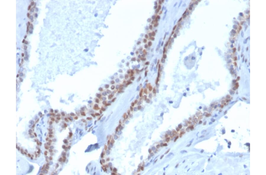Immunohistochemistry - Anti-p40 Antibody [rTP40/3690] (Biotin) (A251228) - Antibodies.com