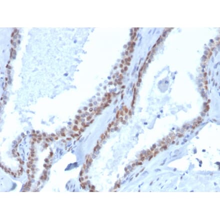 Immunohistochemistry - Anti-p40 Antibody [rTP40/3690] (Biotin) (A251228) - Antibodies.com