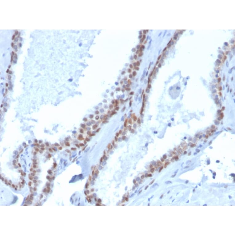 Immunohistochemistry - Anti-p40 Antibody [rTP40/3690] (Biotin) (A251228) - Antibodies.com