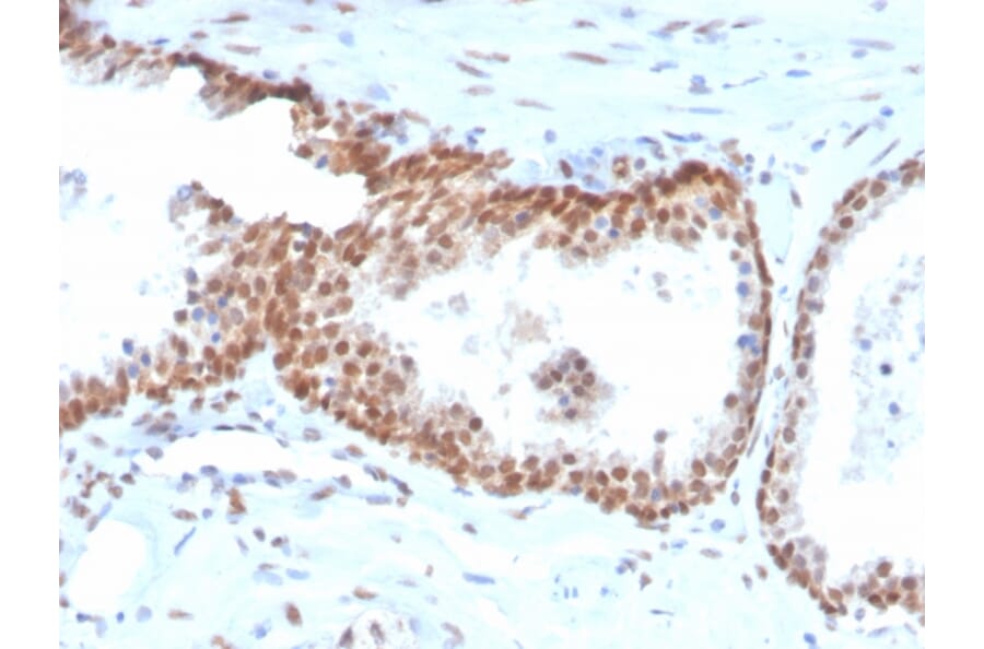 Immunohistochemistry - Anti-p40 Antibody [TP40/3980R] (Biotin) (A251229) - Antibodies.com