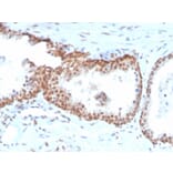 Immunohistochemistry - Anti-p40 Antibody [TP40/3980R] (Biotin) (A251229) - Antibodies.com