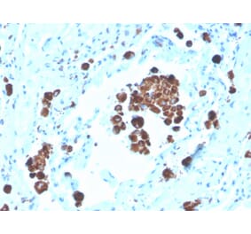 Immunohistochemistry - Anti-NAPSIN A Antibody [NAPSA/3308] (Biotin) (A251232) - Antibodies.com