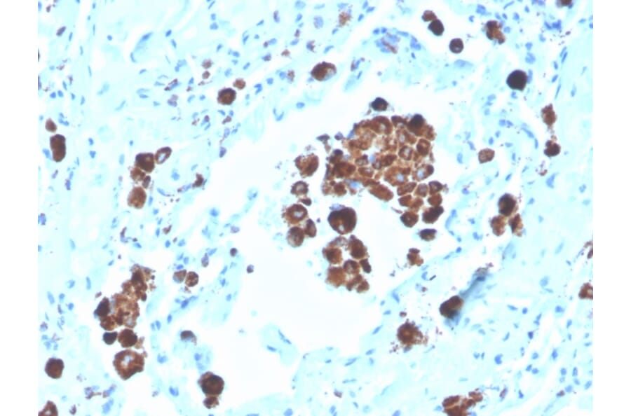 Immunohistochemistry - Anti-NAPSIN A Antibody [NAPSA/3308] (Biotin) (A251232) - Antibodies.com
