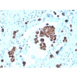 Immunohistochemistry - Anti-NAPSIN A Antibody [NAPSA/3308] (Biotin) (A251232) - Antibodies.com