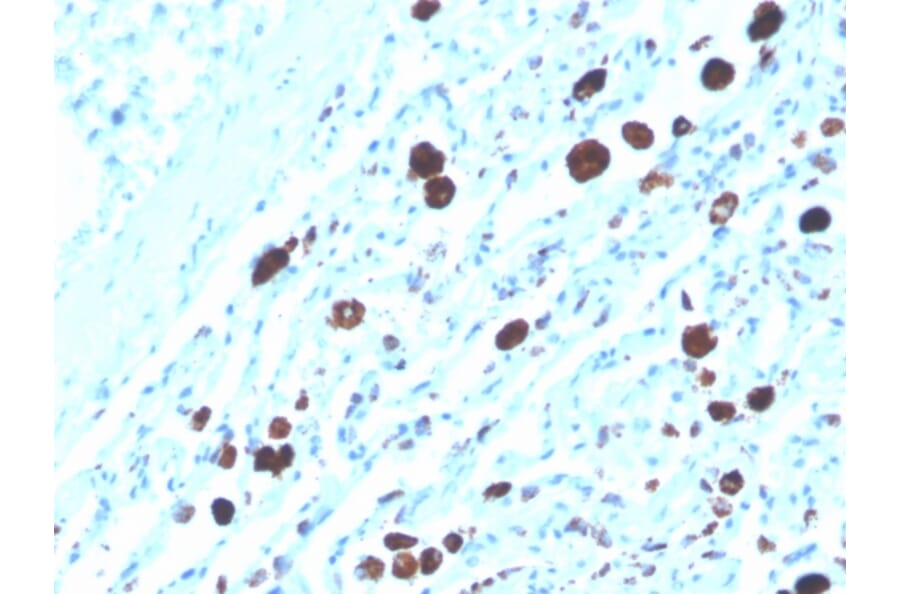 Immunohistochemistry - Anti-NAPSIN A Antibody [NAPSA/3308] (Biotin) (A251232) - Antibodies.com