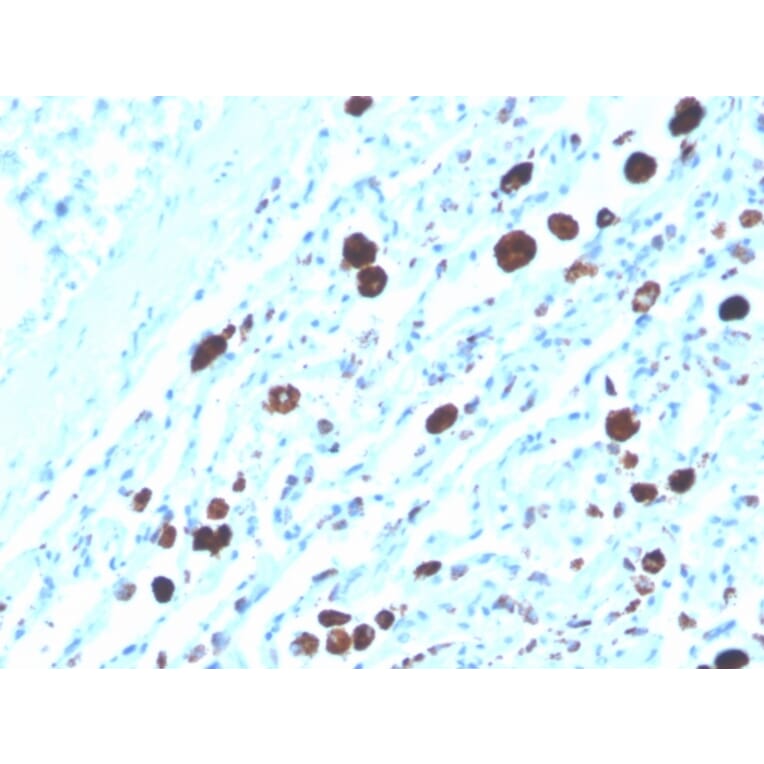 Immunohistochemistry - Anti-NAPSIN A Antibody [NAPSA/3308] (Biotin) (A251232) - Antibodies.com