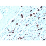 Immunohistochemistry - Anti-NAPSIN A Antibody [NAPSA/3308] (Biotin) (A251232) - Antibodies.com