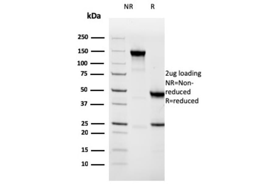 SDS-PAGE - Anti-NAPSIN A Antibody [NAPSA/3308] (Biotin) (A251232) - Antibodies.com