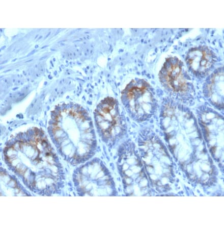 Immunohistochemistry - Anti-CD40L Antibody [CD40LG/2761] (Biotin) (A251233) - Antibodies.com
