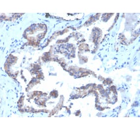Immunohistochemistry - Anti-CD47 Antibody [CD47/3019] (Biotin) (A251234) - Antibodies.com