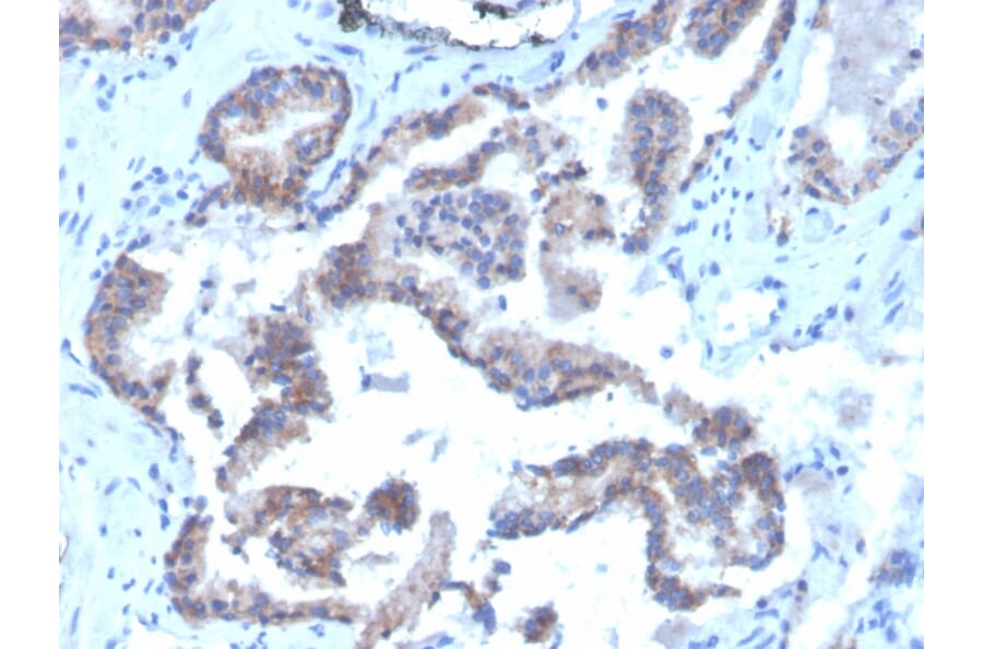 Immunohistochemistry - Anti-CD47 Antibody [CD47/3019] (Biotin) (A251234) - Antibodies.com