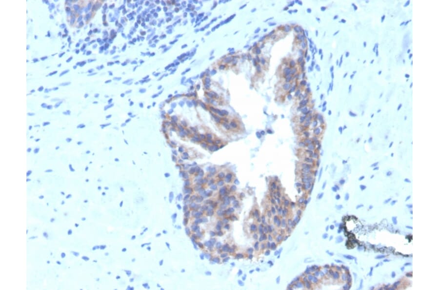 Immunohistochemistry - Anti-CD47 Antibody [CD47/3019] (Biotin) (A251234) - Antibodies.com